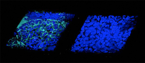 epithelium_poumons_mucoviscidose_1.jpg