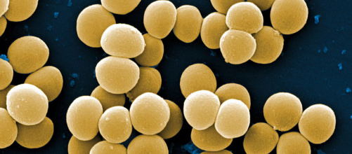 staphylococcus_aureus_1.jpg