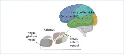 thalamus_1.jpg