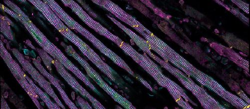 cardiomyocytes_anoxie_1.jpg